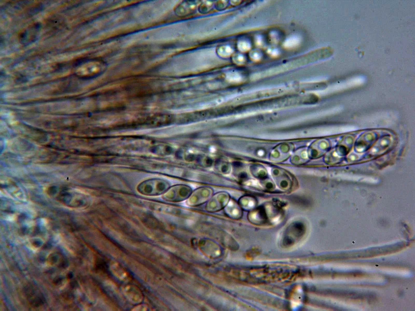 Microscopía de Neobulgaria pura - 10 - Ascas 1